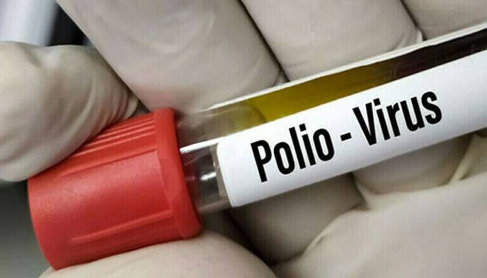 30مالیاتی نمونوں میں پولیو وائرس کی تصدیق 