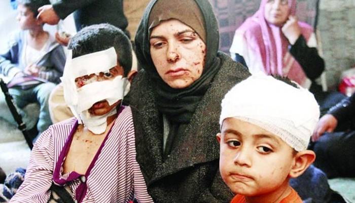 شام، بارودی سرنگ دھماکے میں 8 بچے جاں بحق اور 2 زخمی